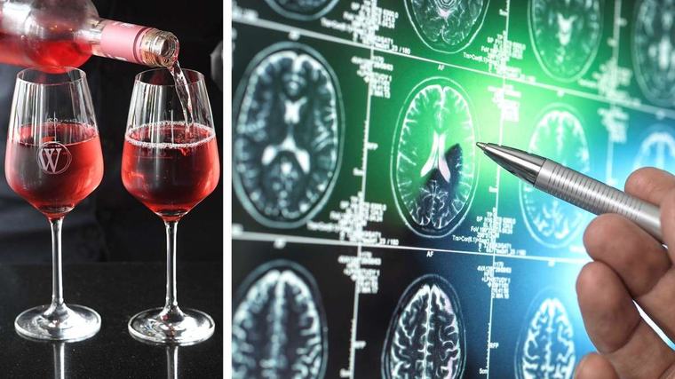 Alzheimer-Forschung mit überraschendem Befund: Strukturelle Veränderungen beginnen deutlich früher