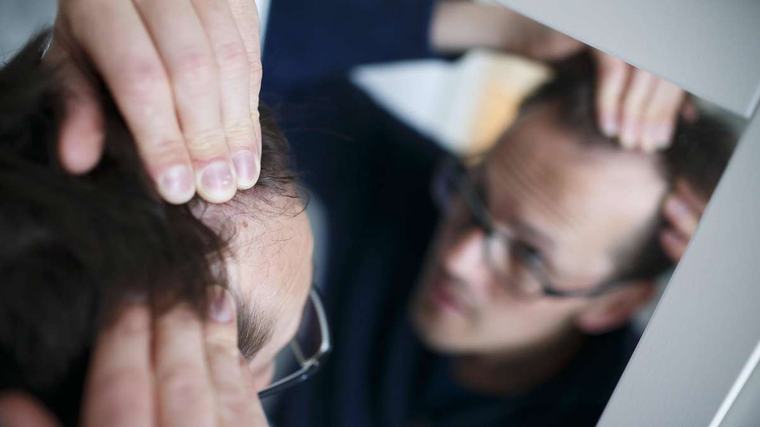 Abnehmspritzen lassen die Kilos purzeln – doch manchen Männern droht Haarausfall