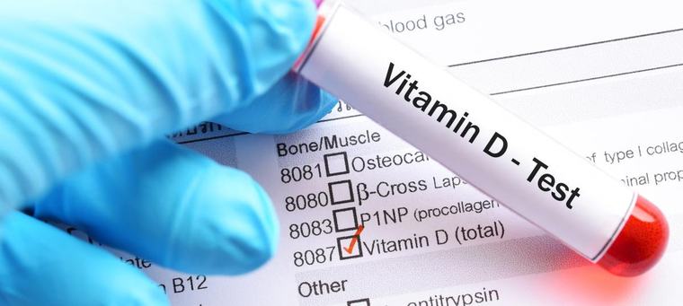 Welcher Vitamin-D-Wert ist optimal? – mit Tabelle